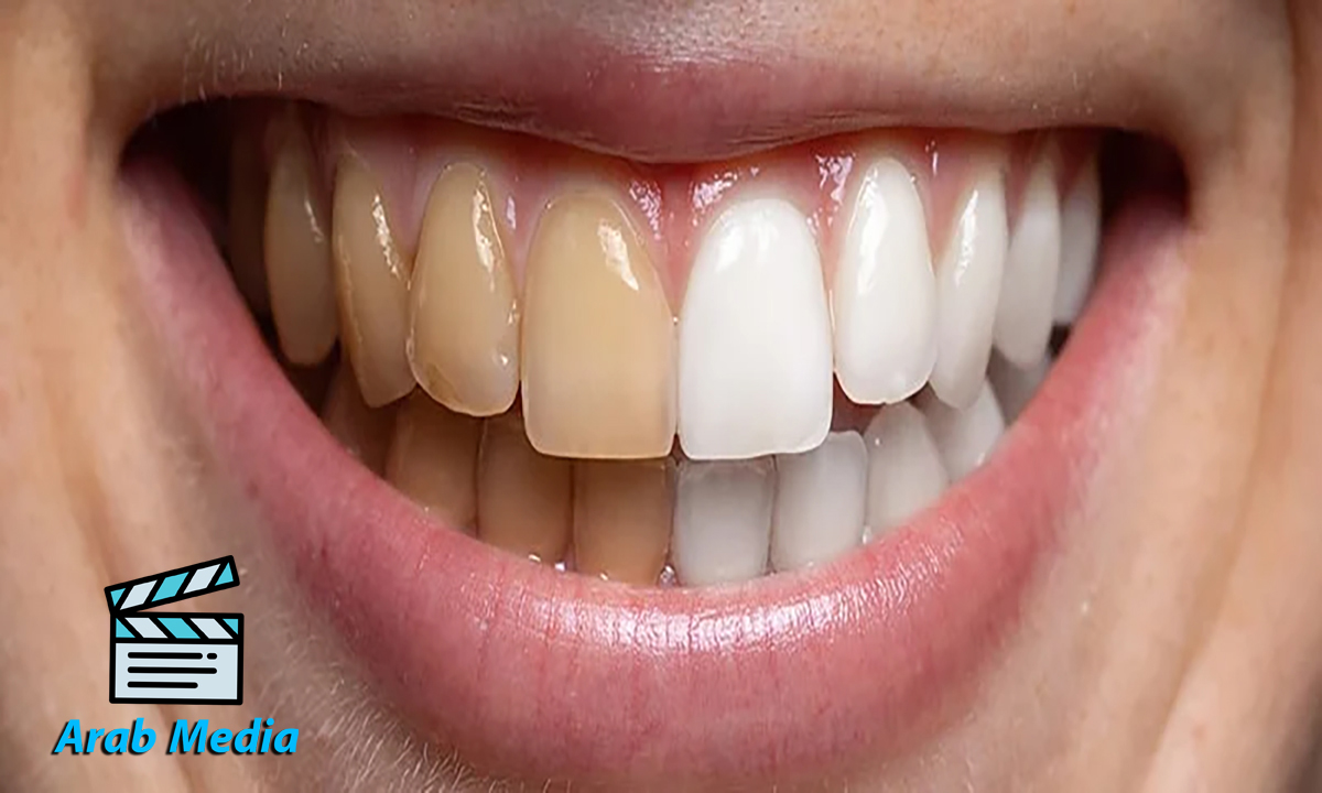 You are currently viewing النتائج ستبهرك كيف تقوم بتبييض الأسنان طبيعياً من خلال 5 طرق وسائل طبيعية